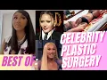 The 5 BEST Celebrity Plastic Surgery Stories