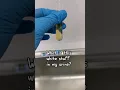 Download Lagu Do you see the white stuff in urine #laboratory #microscope #urinalysis #urinesediment #urinecrystal