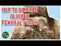 How to Squeeze Blocked Femoral Pores in Bearded Dragons - Cookies Critters