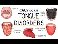 Download Lagu Understanding Tongue Disorders: Causes and Management