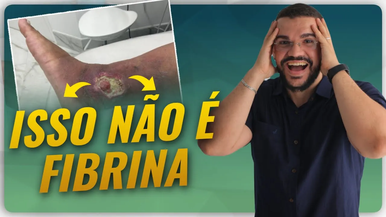 ISSO AQUI NÃO É FIBRINA ENTENDA (Fibrina ou Esfacelo)?