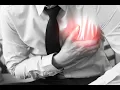 Thromboendarterectomy CPT code - simplify medical coding