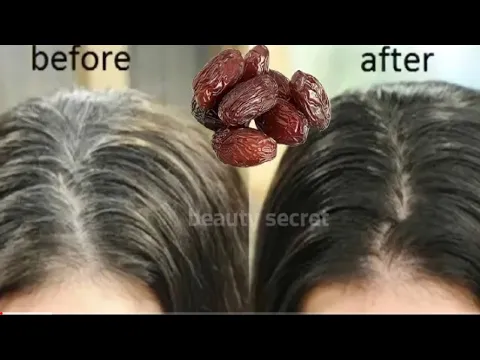 Download MP3 From black hair to white hair naturally in just 5 minutes! 100% effective