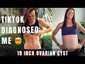 Download Lagu TikTok Diagnosed Me (19 inch Ovarian Cyst)￼