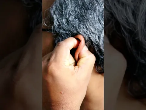 Press This ear point for 8-Hour Deep Sleep #sleepbetter #apakahealthguru #acupressure #shortsfeed