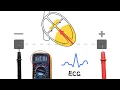 ECGs - How they work