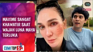 Download Bikin Panik,, Maxime Bouttier Sangat Khawatir Saat Melihat Wajah Luna Maya Tampak Terluka MP3