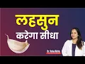 Download Lagu लहसुन के चमत्कारी फायदे || in Hindi || Dr. Neha Mehta