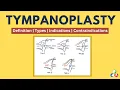 Tympanoplasty - Definition Types Grafts Indications Contraindications
