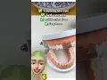 Download Lagu Moldable false teeth ✅ #tipsandhacks