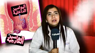 البواسير اسبابها و طرق العلاج منها مع الدكتورة سناء مطيع 