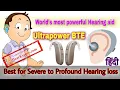 Download Lagu World's most powerful Hearing aid for Severe to Profound Hearing loss | Oticon Xceed Ultrapower BTE|