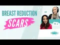 The secret to invisible breast reduction scars