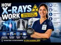 How X Rays Create Medical Images