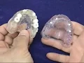 Radiographic and Surgical Implant Templates for the Completely Edentulous Fabrication Technique