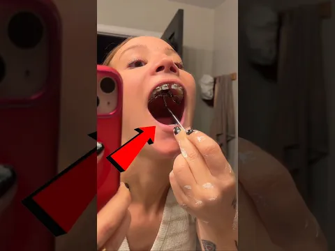 ¡Su Sonrisa Se Convirtió En Pesadilla😱#catsoftiktok #CatLovers #cat #cute #funnycats#catcartoon #fyp