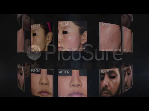 Video abspielen: Tattooentfernung mit dem PicoSure-Laser