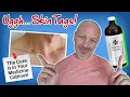 Skin Tag CURE with Hydrogen Peroxide Dr Doug