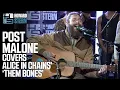 Download Lagu Post Malone Covers “Them Bones” Live on the Stern Show