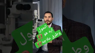 الحول انحراف العين اعرف أنواعه وطرق علاجه مع افضل دكتور عيون في مصر د عمار نصار علاج الحول 