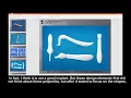 Download Lagu The History Of Nasal Implant  [H plastic surgery]