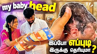 எங்க குழந்தைக்கு தலை இப்புடிதா இருஞ்சு 😰