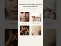What s Causing Your Acne Breakouts
