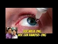 Lagu Dry Eyes : Nagluluha, Parang May Buhangin? - ni Doc Willie Ong #731