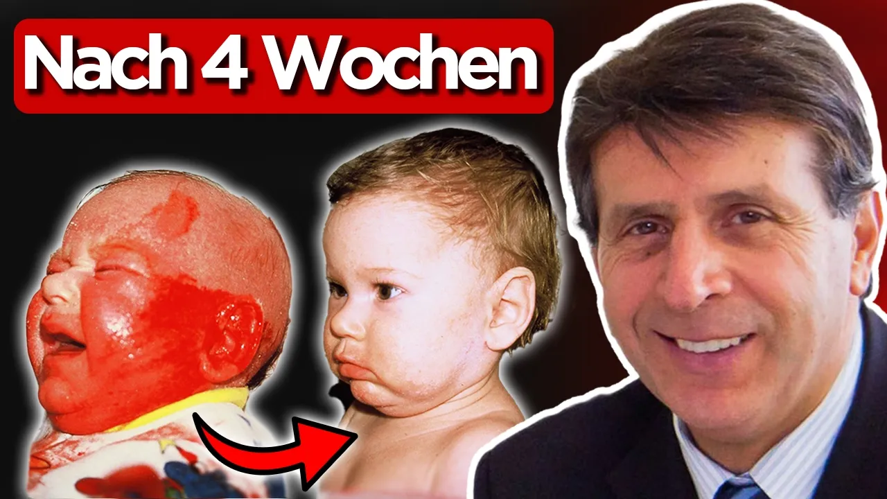 Die harte Wahrheit hinter Allergien & Autoimmun-Erkrankungen (Dr. John Ionescu)