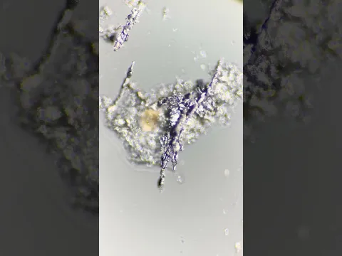 There may be microscopic bits of METAL in your CEREAL!?