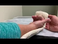 Modified Saint Johns Protocol with the Four Finger Technique