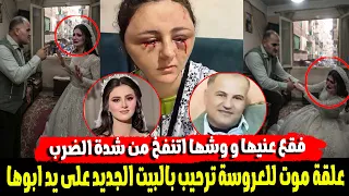 وشها اتنفخ من شدة الضـ ـرب ..علقة مـ ـوت للعروسة ترحيب بالبيت الجديد على يد ابوها والسبب مرعـ ـب