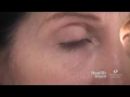 Eye Twitches Eye Spasms Oh My Health Watch Extended Version