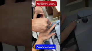 ก้อนที่เกิดขึ้นที่นิ้วกลางของผู้ป่วยอายุ 63 ปี เกิดจากสาเหตุอะไรบ้าง