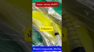 ทำไมการควบคุมระดับยูริกในเลือดถึงสำคัญสำหรับผู้ป่วยเก๊าทเรื้อรัง 