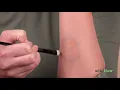 How to Cover Up a Bruise