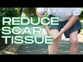 How to Get Rid of Knee Scar Tissue NOW Naturally