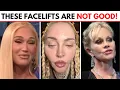 5 Popular Facelift Procedures to AVOID
