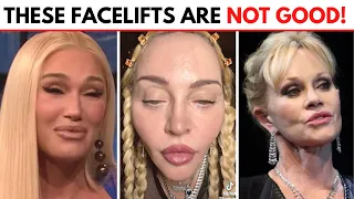 5 Popular Facelift Procedures to AVOID