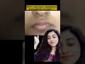 Download Lagu Do you have darkness around your mouth?!#skincare #dark #cosmetics #skin #shortsviral