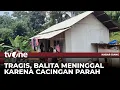 Download Lagu Kisah Tragis Dialami Balita di Sukabumi, Menderita Cacingan Parah dan Tidak Diobati Sejak Awal