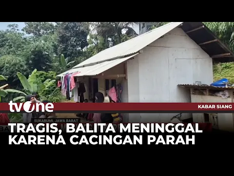 Kisah Tragis Raya, Balita di Sukabumi yang Meninggal karena Menderita Cacingan Parah