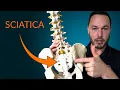 Download Lagu Understanding Sciatica- Everything you need to know about the causes and treatment of sciatica.