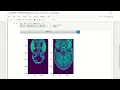 7 Preprocessing in Python Part 1