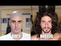 Download Lagu Two years time lapse of hair growth