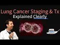 Lagu Lung Cancer Staging Explained Clearly by MedCram.com