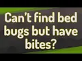 Can t find bed bugs but have bites