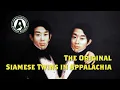 The Most Famous Conjoined Twins From Siam to Appalachia