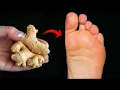 Download Lagu Put ginger on your leg and be amazed at the result! Great natural advice