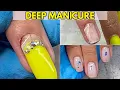 What Happens When a Manicure Goes Too Deep Shocking Nail Damage